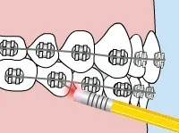 poking wire